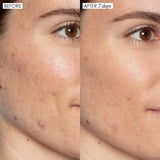 Sunday Riley  Good Genes All-In-One AHA Lactic Acid Treatment 30ml NIB - LAB