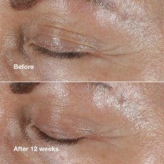 Clinique Smart Clinical Repair Wrinkle Correcting Eye Cream in 15ml jar, showing the unopened beauty product with branding and packaging.