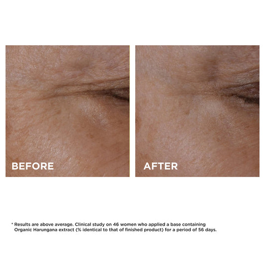 Clarins Total Eye Lift Firming & Smoothing Anti-Aging Eye Cream NIB 15ml
