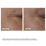 Clarins  Total Eye Lift Firming & Smoothing Anti-Aging Eye Cream NWOB 15ml - LAB