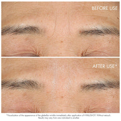 Dior Capture Totale Hyalushot wrinkle corrector with hyaluronic acid in a 15ml bottle, new and unopened, for anti-aging skincare.
