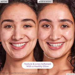Glow Recipe Blackberry Retinol Blemish Serum bottle with dropper, showcasing the skincare product for blemish treatment.