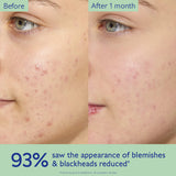 Caudalie  Vinopure Oil-Control Moisturizer for Acne Prone Skin 60ml NWOB - LAB