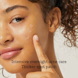 COSRX Acne Pimple Master Patches